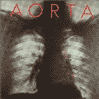 Aorta Aorta CD